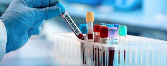 APOLİPOPROTEİN C II