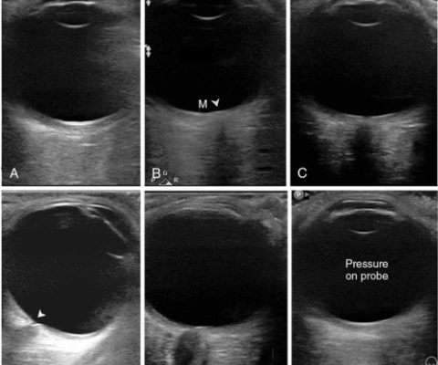 göz ultrasonu fiyatları