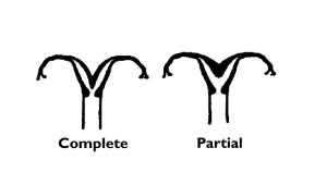 rahim filmi fiyatları
