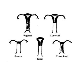 rahim filmi hsg fiyatları